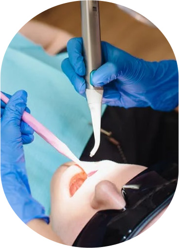 Root Canal Treatment