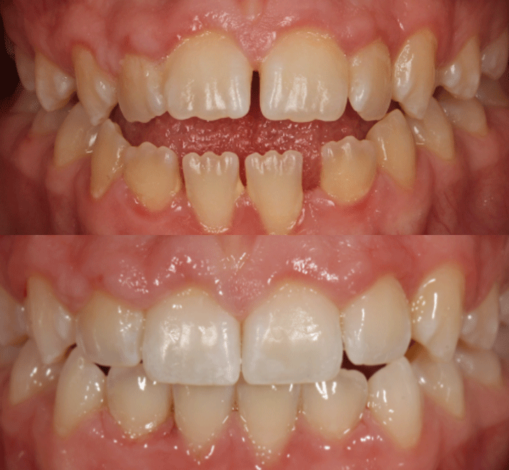 Smile Gallery