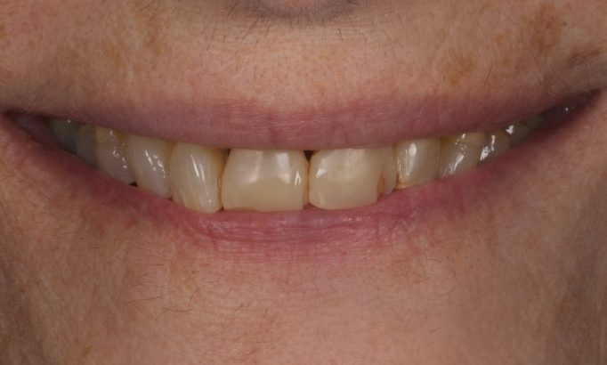 Before - Revive Clinic