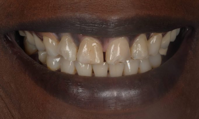 Before - Revive Clinic