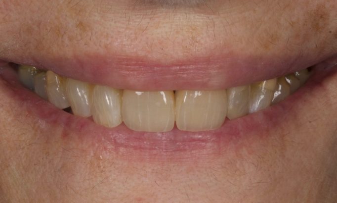 After -Revive Clinic