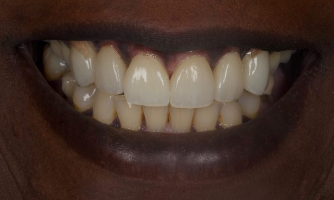 After -Revive Clinic